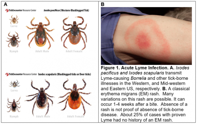 Lyme Disease Ticks