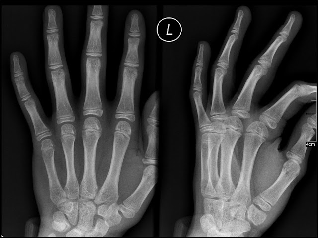 Medical X-rays – Radiological Imaging From Film to Digital X-rays medical x-rays